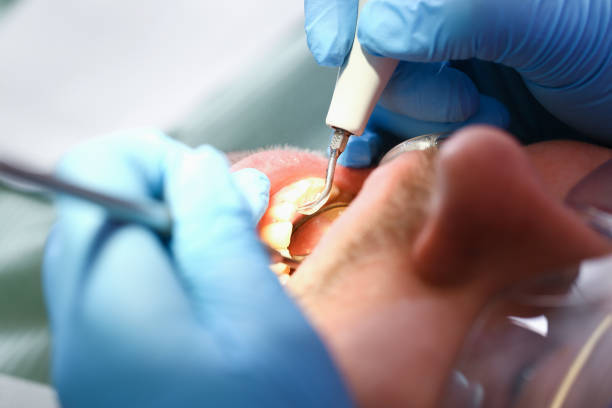 Best Urgent Care for Lost Fillings or Crowns in Keys, OK