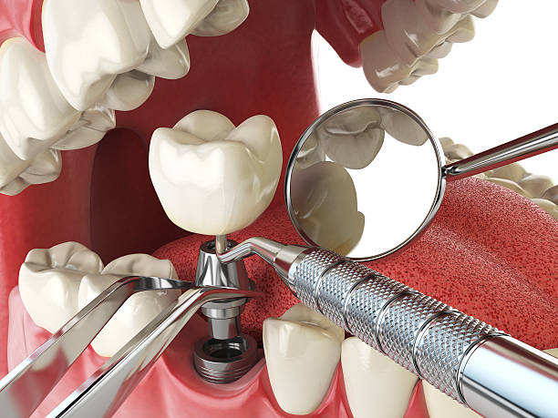 Best Emergency Denture Repair in Keys, OK